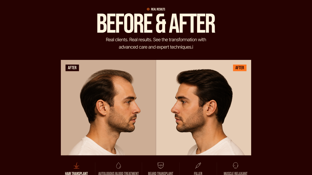 Before After Section - Astrox