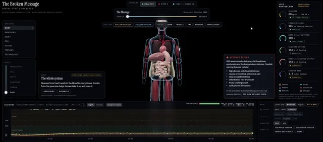 1型糖尿病交互3D科普